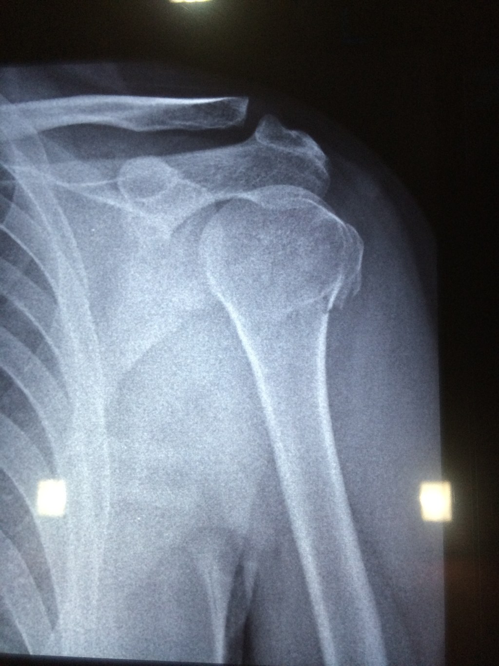 Taking photos of X-ray slides at&nbsp;home